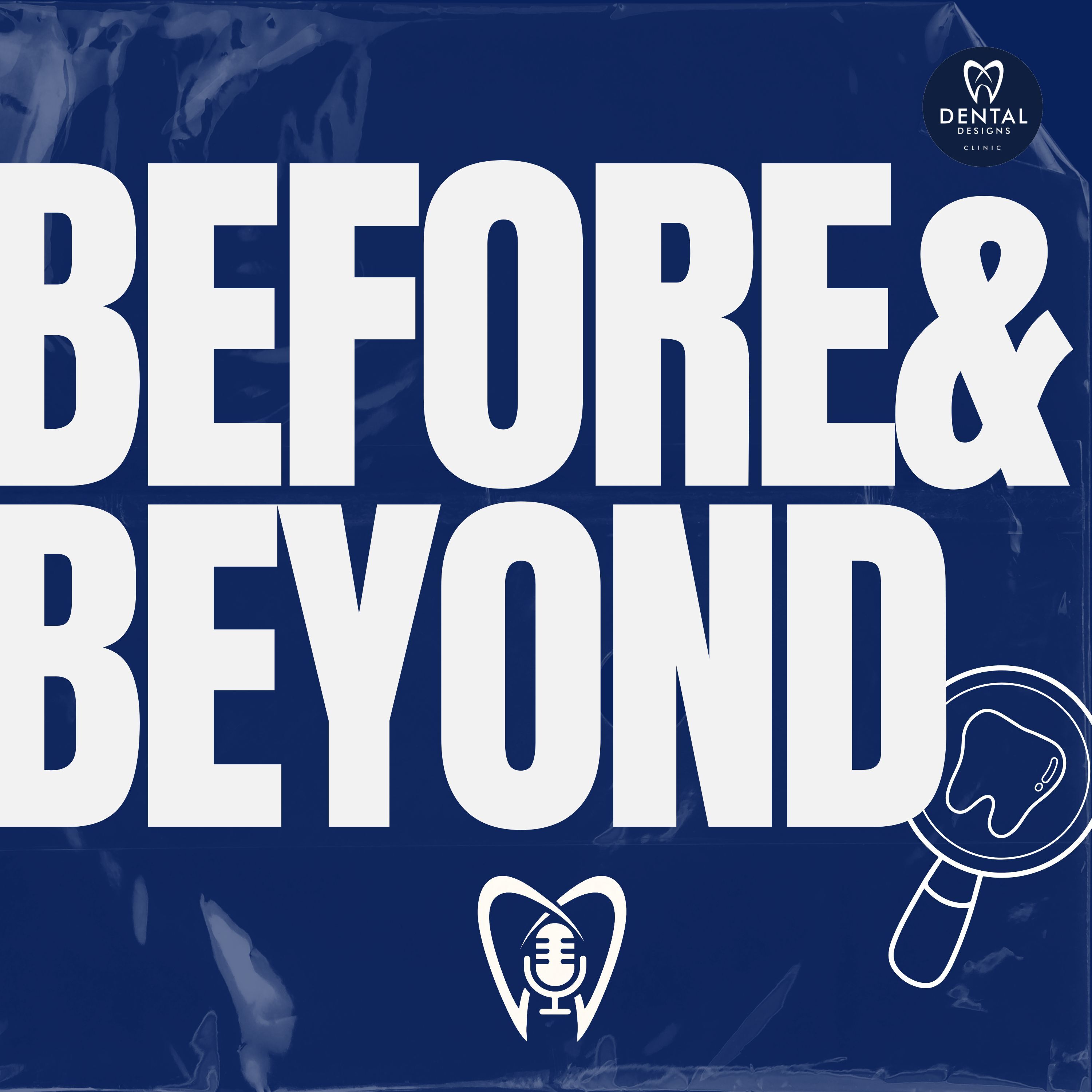 Effective Methods to Remove Stains from Teeth (SCALING & POLISHING) | BEFORE & BEYOND EP38